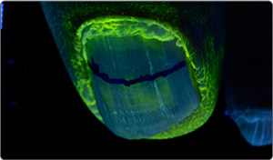 UV light after application 1